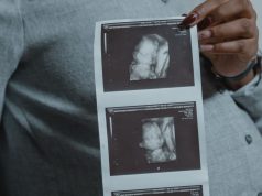 Thai 14 tuần: bé lớn lên thế nào và mẹ nên chăm sóc ra sao? Mẹ bầu cầm ảnh siêu âm khi theo dõi thai kỳ tuần 14