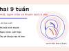 Thai 9 tuần phát triển như thế nào? Dấu hiệu mẹ bầu cần biết Thai 9 tuần: mí mắt, ngón chân và khuôn mặt rõ dần